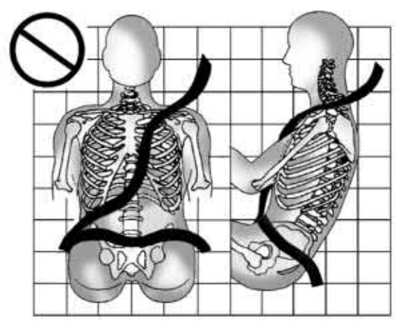 18. Parasóis - Ilustração técnica do manual