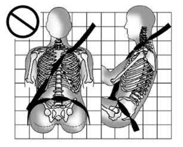 18. Parasóis - Ilustração técnica do manual