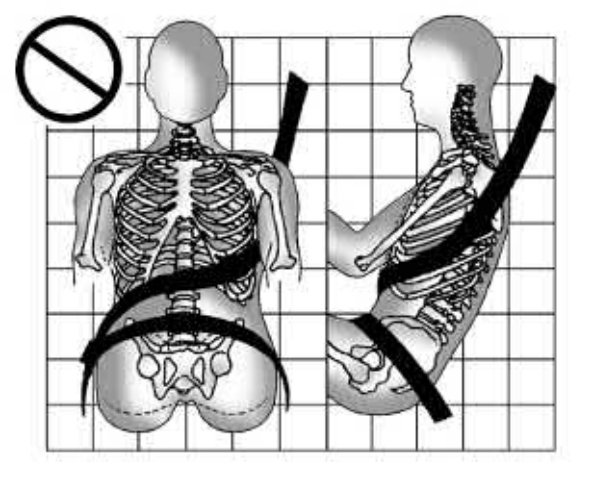 18. Parasóis - Ilustração técnica do manual