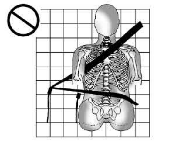 18. Parasóis - Ilustração técnica do manual
